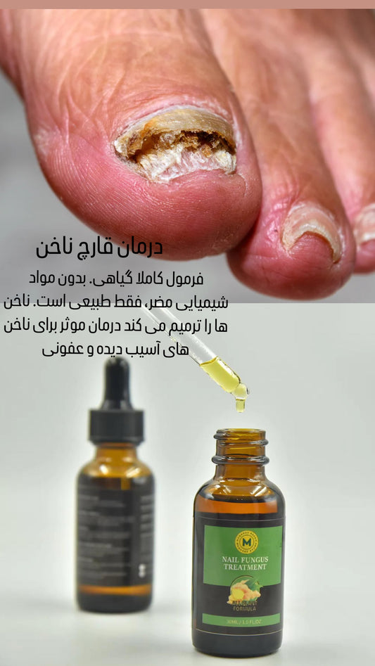 Nail fungus treatment